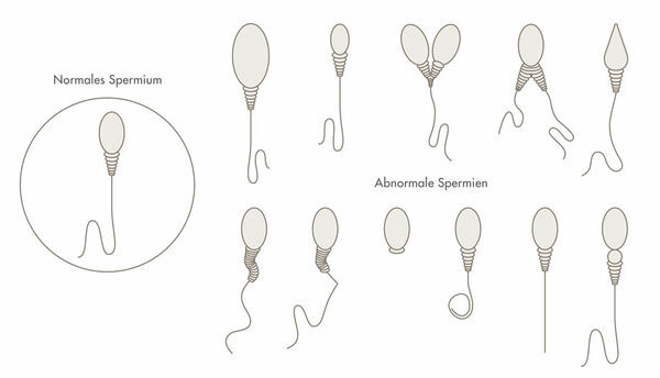 Spermiogramm, Wunschkind Klinik Wien Dr. Brunbauer